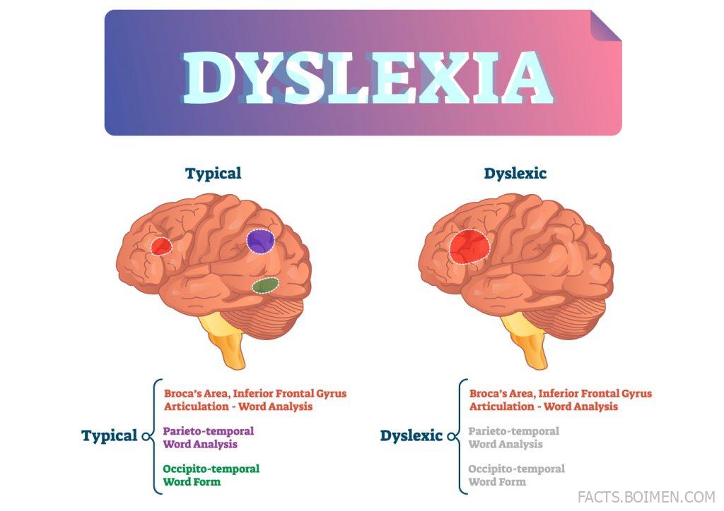 What It Feels Like to Read With Dyslexia – This Website Lets You Experience It